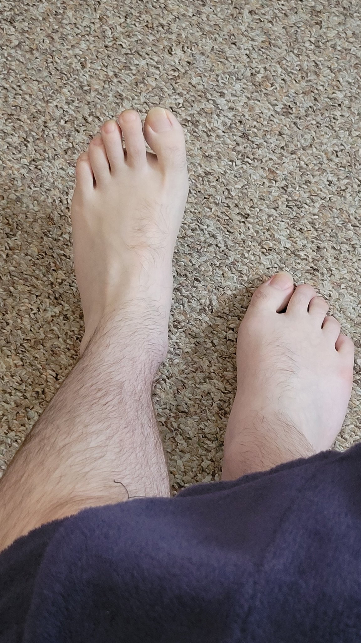 2 pic. Feet size 13W

#feet #manfeet #gayfeet #footfet?sh https://t.co/q6TBlMBa1D