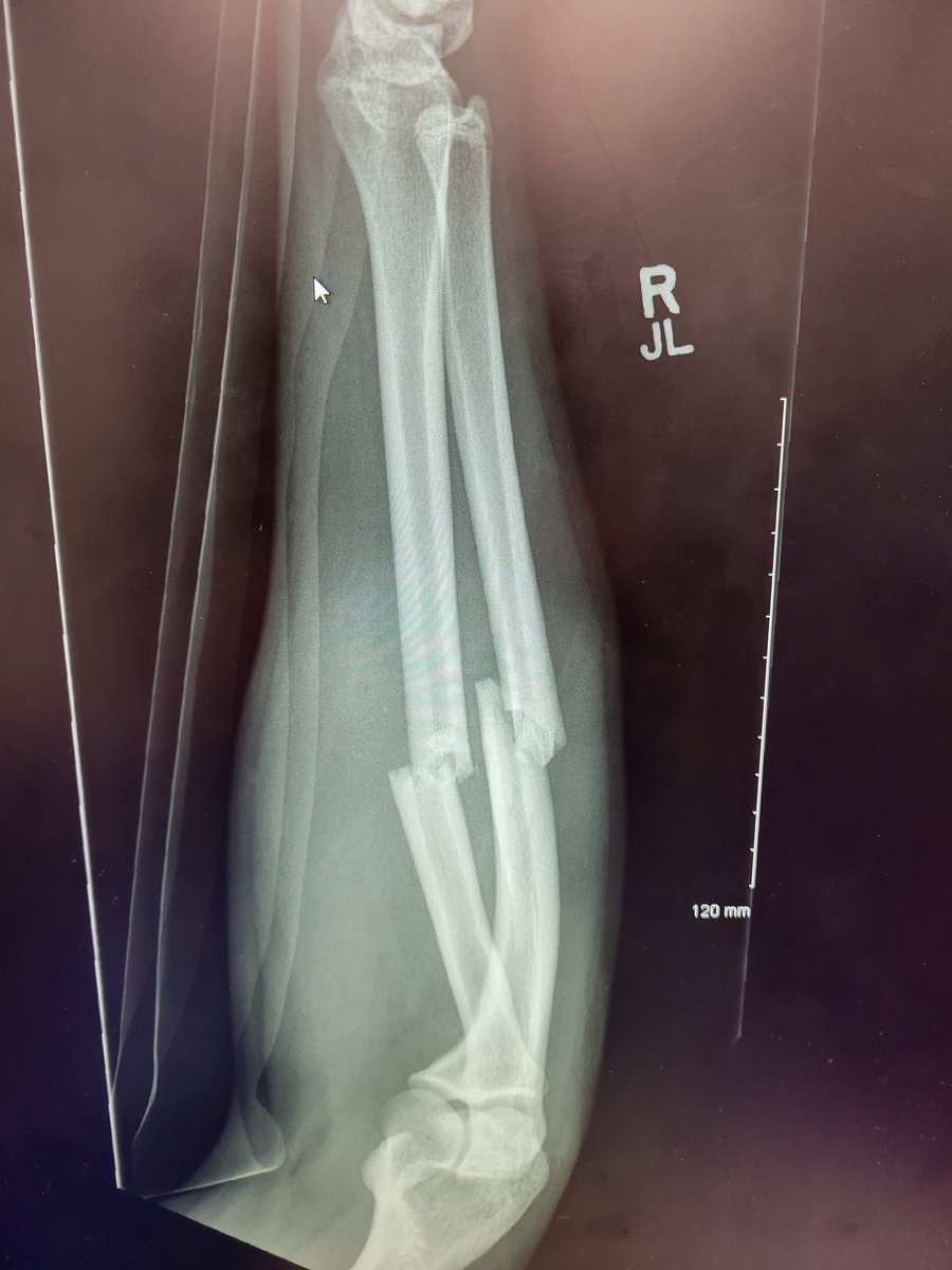 Kyle Buckner tweet media