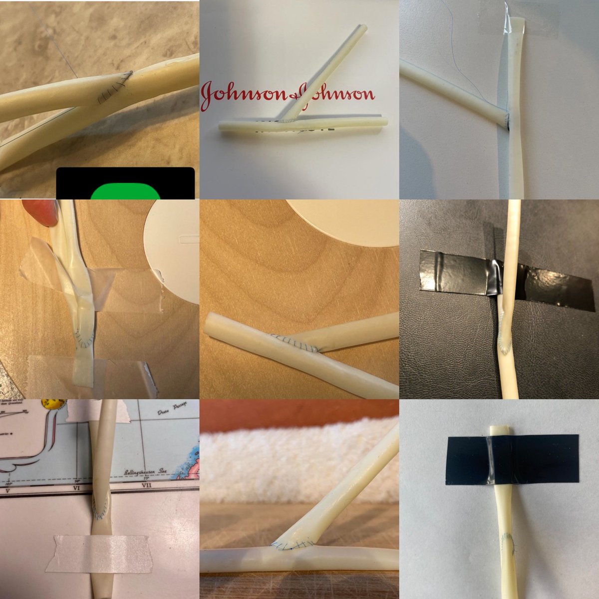 BobbyYanagawa's tweet photo. After 3 months, hundreds of hours, 140+ Canadian medical students improved their surgical skills. So proud of their tenacity and grit. Many staff-level anastomoses! Congrats! Thank you to Dept Surg and Ethicon for support @EthiconCanada @najmadoc @UnityHealthTO @DVervoort94 https://t.co/CuD2tpZ4PG