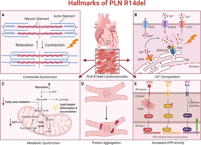 CardiologyUmcg's tweet photo. Precision medicine for targeting PLN R14del. A beautiful review by Frits Deiman. Let's see what the future will bring us! #heartfailure @SpringerNature https://t.co/Sv7HwzFgNH