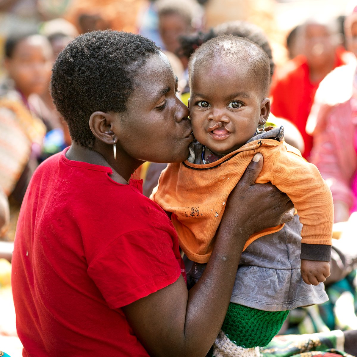 OpSmileIrl's tweet photo. Every 3 minutes, a child is born somewhere in the world with a #cleftcondition. In Ireland, children are operated on in their 1st year, but it's a different story for kids like Grace in #Malawi. That's why its our mission to find &amp; treat 1million patients in our next decade! https://t.co/IyAYnBBZ9R