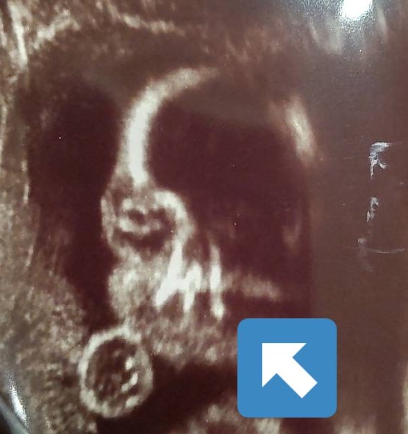 ちもちゃんまま Chimochan Mama Twitter ちもちゃんまま Chimochan Mama Twitter