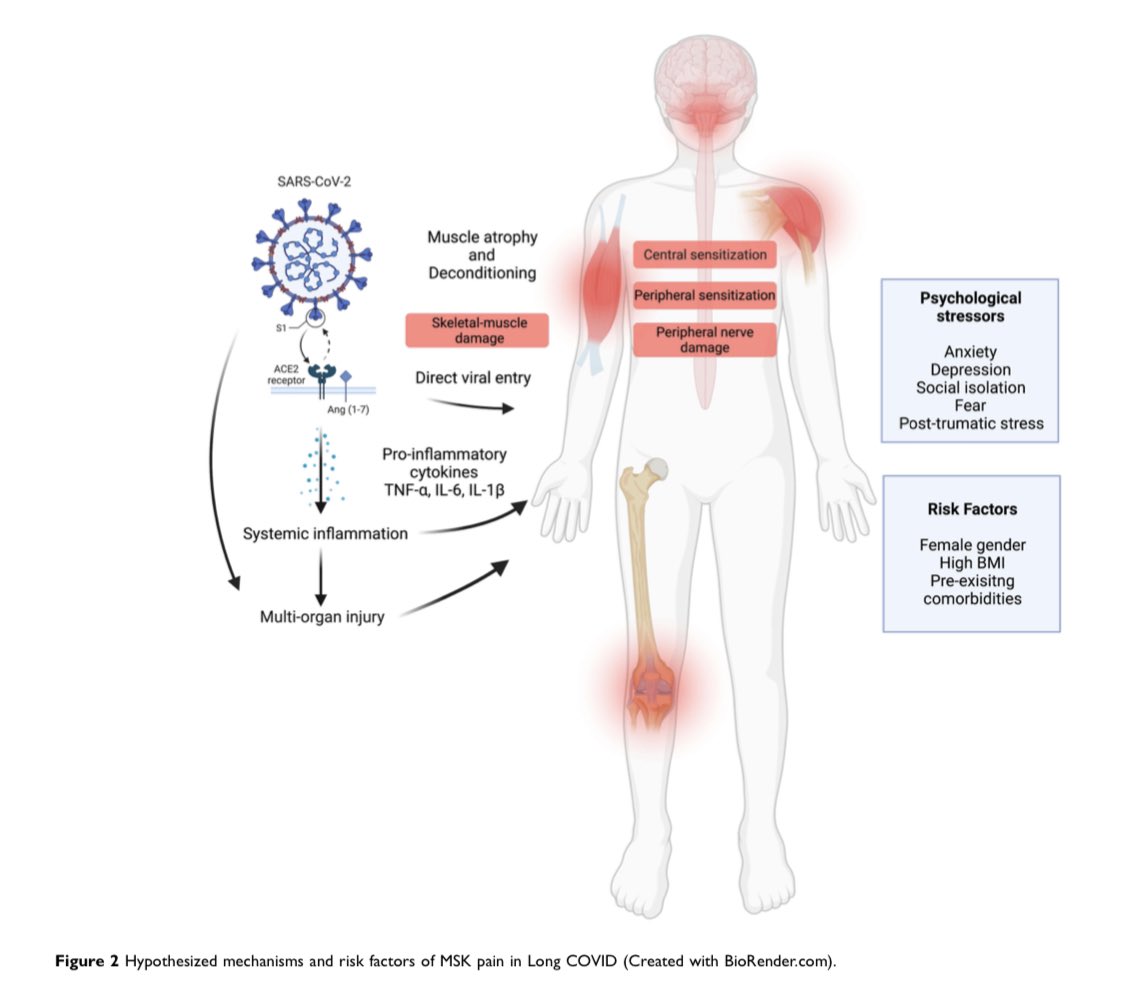 Super excited to announce that the first paper from my PhD has now been published in <a href="/JPainResearch/">Journal of Pain Research</a> 🎉🤩

#myfirstfirstauthor
#phdlife
#LongCovid 

Check it out, It is #openaccess 
doi.org/10.2147/JPR.S3…

A massive thank you to the super awesome team for their incredible input!