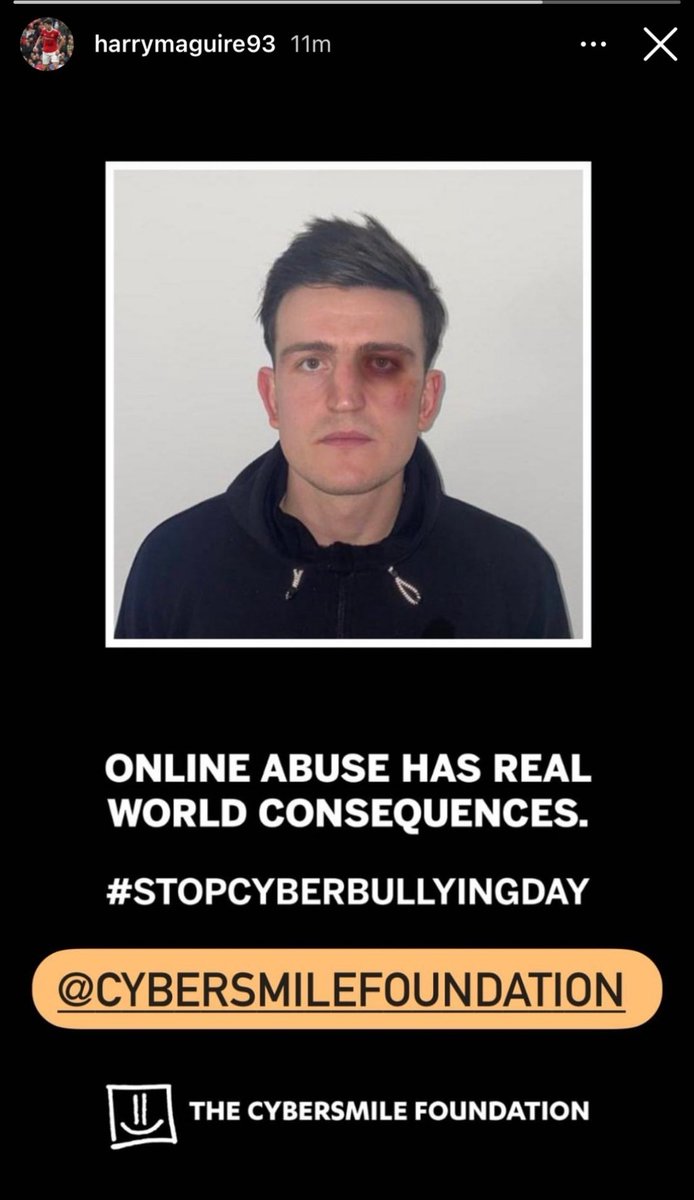 Some players bled to win this club trophies.  

Others photoshop fake bruises on themselves for a PR stunt as they drag the club down to its longest run without a trophy in half a century. 

Hope this helps