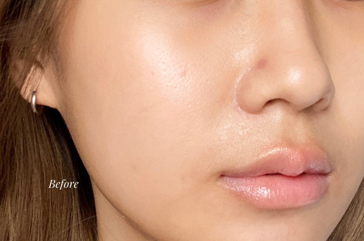 Hamkdy_'s tweet photo. ก็ต้องจัดแล้วป๊ะ Eucerin Crystal Serum ตัวใหม่ เนื้อเบาถูกใจทางนี้มาก เรื่องรักษารอยดำ เรื่องงานปรับสีผิวให้สม่ำเสมอกันก็คือไม่แผ่วเลยจ้า คือยกให้เป็นตัวท็อปเรื่อง #ผิวโกลว์ใสไร้จุดดำ อย่างที่แบรนด์เค้าบอกเลย ทำได้ดี ทำได้ปังเพราะไทอามิดอลเลย สุด! #EucerinCrystalSerum https://t.co/SO8XtxLoOj