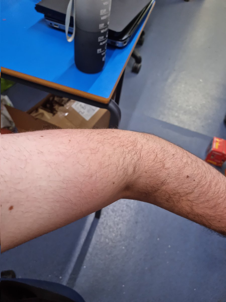 Not quite as horrific as some of the teacher tans out there but it's a work in progress 😉  #PE #TeacherLife #teachertanlines