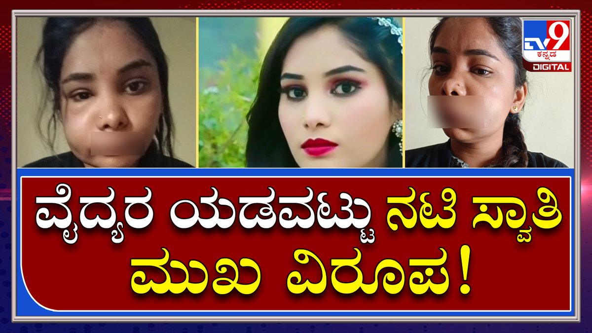 tv9kannada's tweet image. Actress Swathi: ವೈದ್ಯೆ ಯಡವಟ್ಟಿನಿಂದ ನಟಿ ಸ್ವಾತಿ ಟಿವಿ9ಗೆ ರಿಯಾಕ್ಷನ್! | Tv9 Kannada

Video Link►youtu.be/uvk3DBKW6BE
 #ActressSwathi #DentalClinic #SideEffect #ActressChethanaDeath #LatestNews