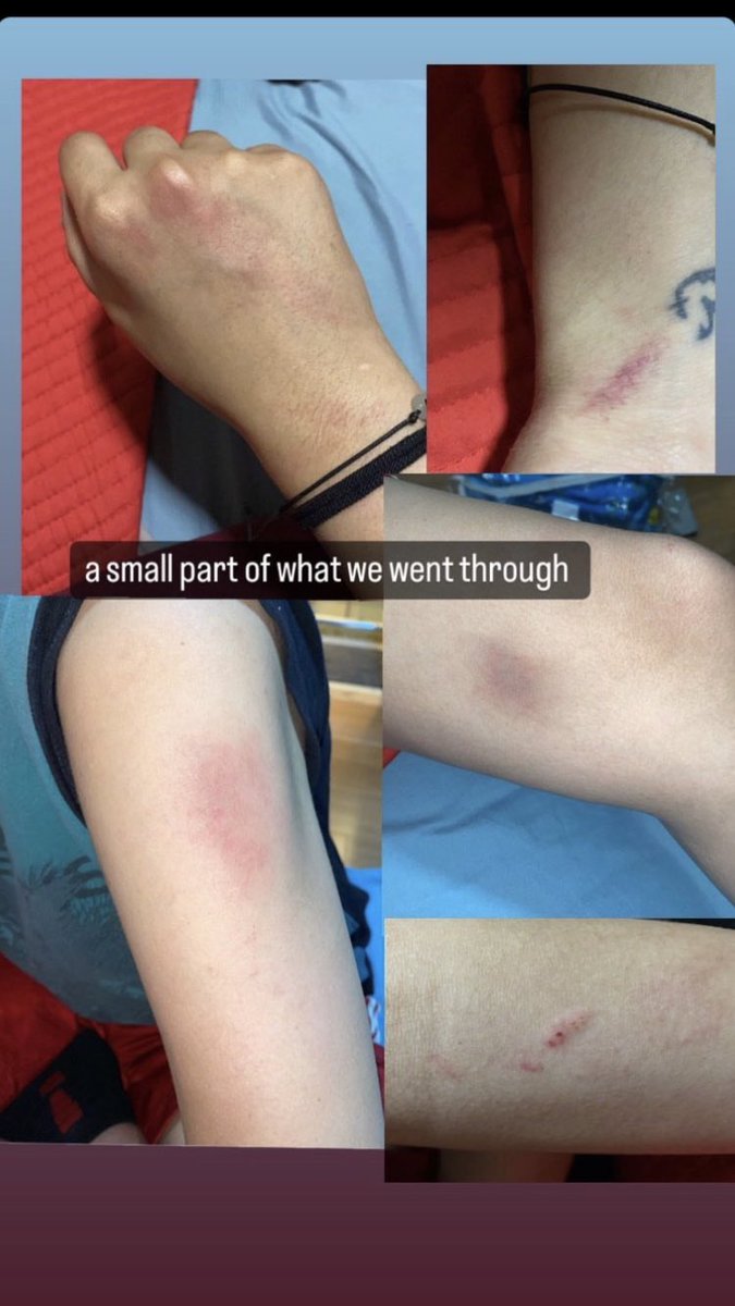 لحد الأن مش مستوعب كيف ممكن زلمة يمد ايدو ع بنت ؟ ٣ جحوش لا عندهم لا كرامة ولا شرف مبارح تهجمو على بنتين بنص الشارع !! مش فاهم احنا وين عايشين ؟ مافي ولا سبب ولا مبرر بخليهم يتصرفو هيك تصرف . الواحد صار يخاف يطلع من باب البيت .