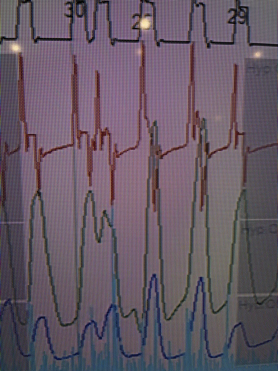 SOMNONIV group tweet media