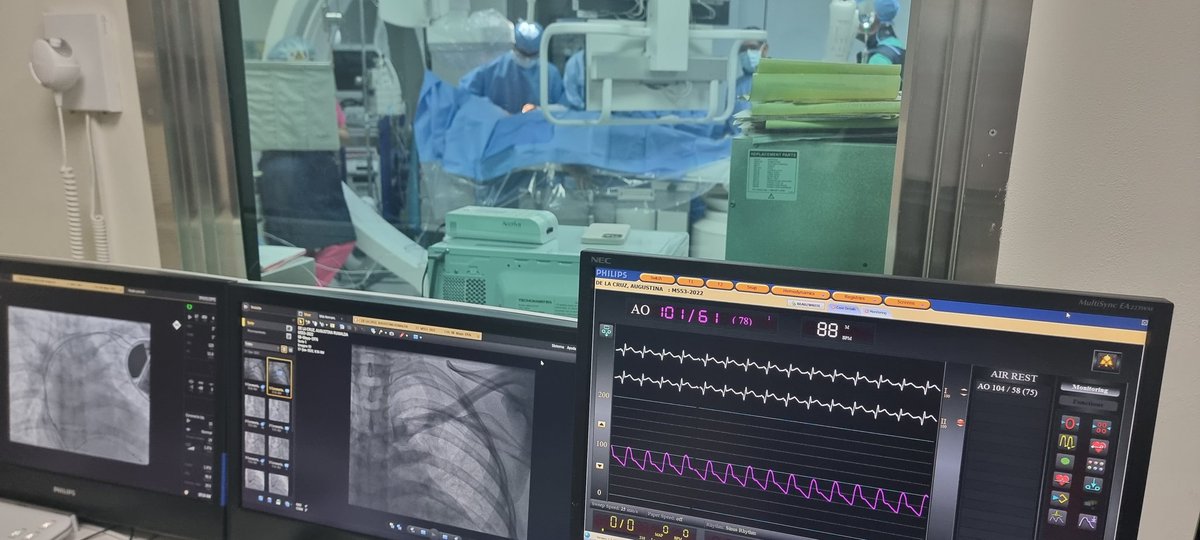 urenacard's tweet photo. Después de dos años de pandemia reiniciamos nuestras jornadas, esta vez beneficiando 8 pacientes de escasos recursos con Desfibriladores y Resincronisadores. @MejiaEliany @CardioUva @heartcaredom   @ Centro Medico Moderno. https://t.co/MghTim1lMx