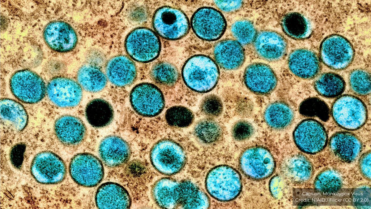 SSHAP_action's tweet image. NEW BRIEFINGS ON #MONKEYPOX. 📝

Given current uncertainty &amp;amp; misinformation, understanding social perspectives of the virus is critical.💭

Read our 2 new briefs on responding to Monkeypox:
Social Considerations:👉socialscienceinaction.org/resources/soci…
RCCE Strategies:👉socialscienceinaction.org/resources/rcce…