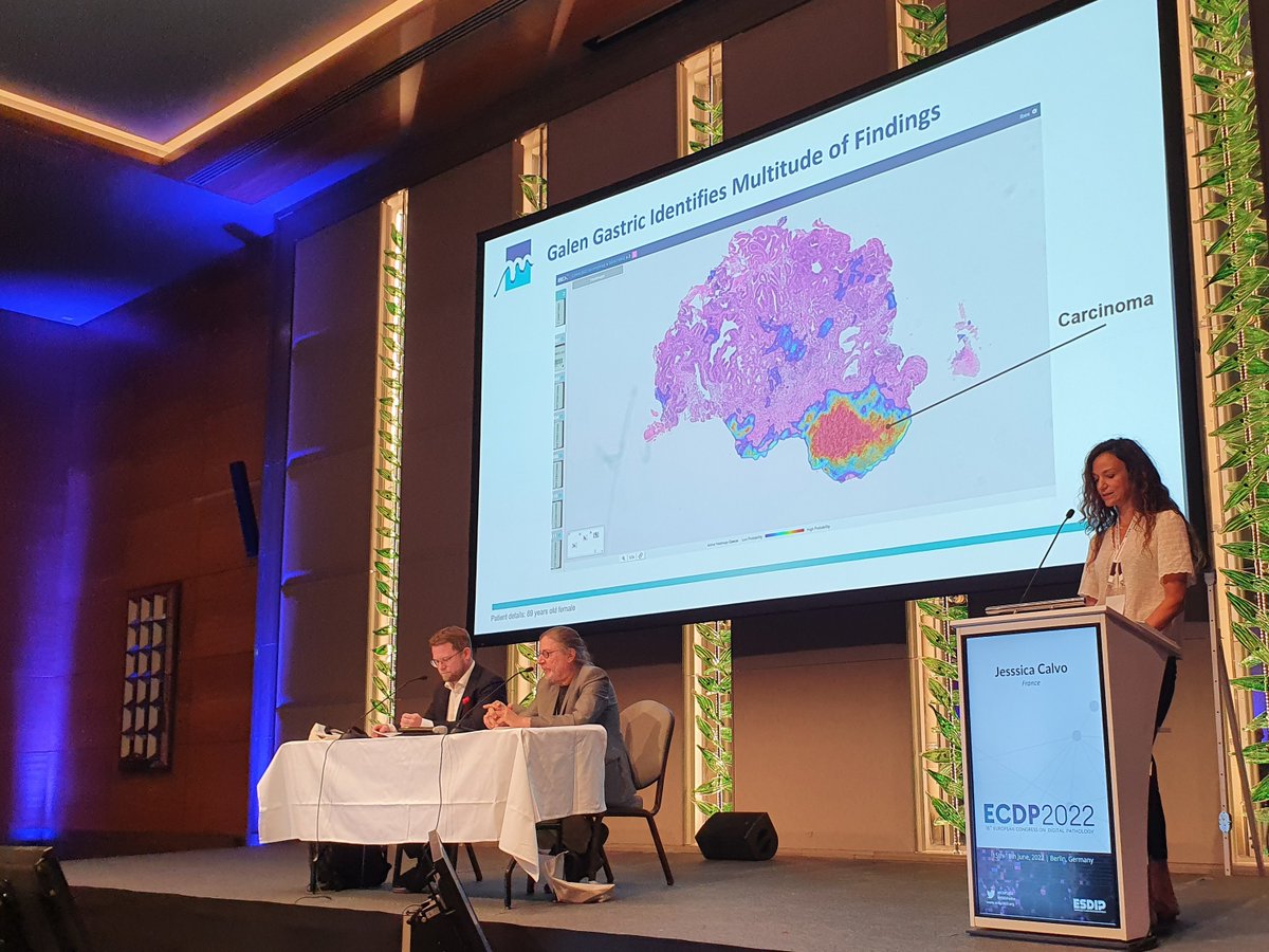 IbexMedAx's tweet image. Full house at #ECDP2022 with @calvojessik as she presented her study, demonstrating very high accuracy for #AI in detecting #gastric #cancer, H. pylori and other pathologies, opening the door for broader adoption of AI in #GI #pathology. @ESDIPatho #ia #digitalpathology