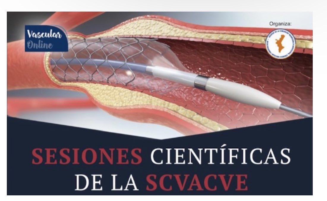 CVA_DrPeset's tweet photo. Magnífica exposición por nuestra residente @CVA_DrPeset , Dra. Goran @GoranElena del @GVADrPeset 
“Isquemia Medular en EVAR complejo” en las sesiones científicas de la @svacv_vascular https://t.co/5nO8tUdiwP