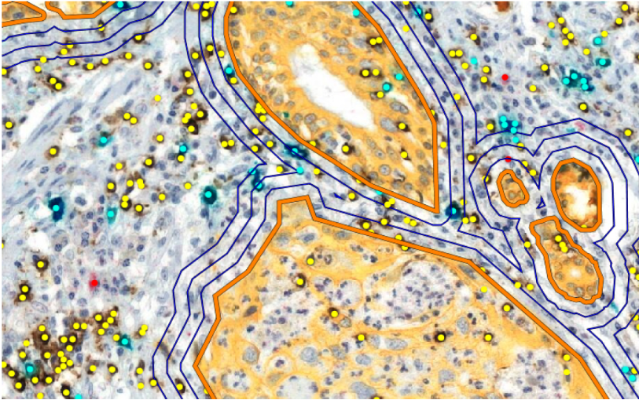 Call for papers: Spatial Analysis in Biological Imaging

🔬 cambridge.org/core/journals/…

#BioImageAnalysis #BioImaging #BiologicalImaging #Microscopy #ImageAnalysis #SpatialAnalysis #FluorescenceMicroscopy #CellBiology #FluorescenceImaging #CellImaging #CellularImaging