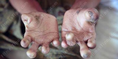 César Rodrigues🚩 tweet media