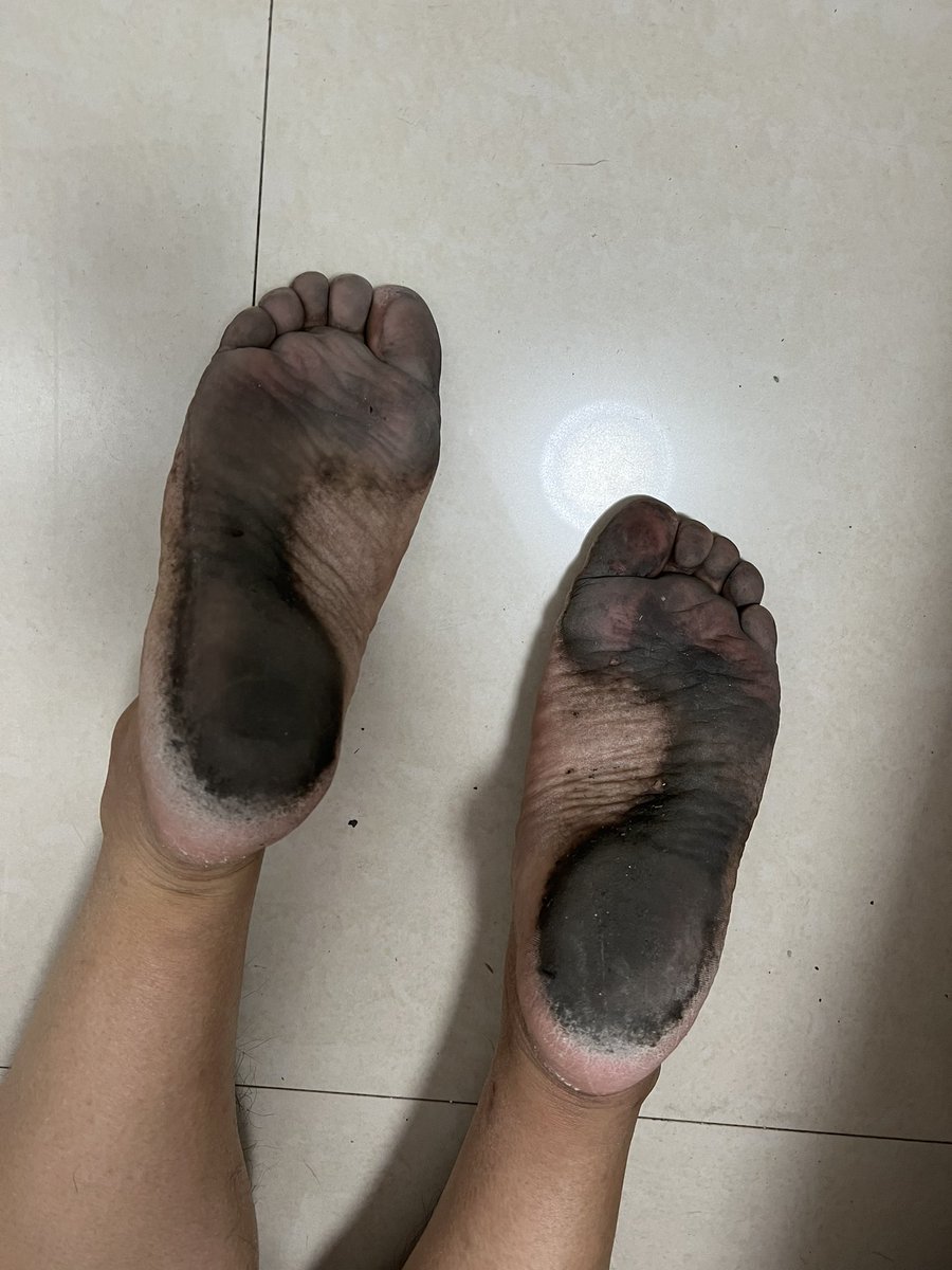 今晚走了很久去了很多人多的地方脚底黑黑的，很开心。