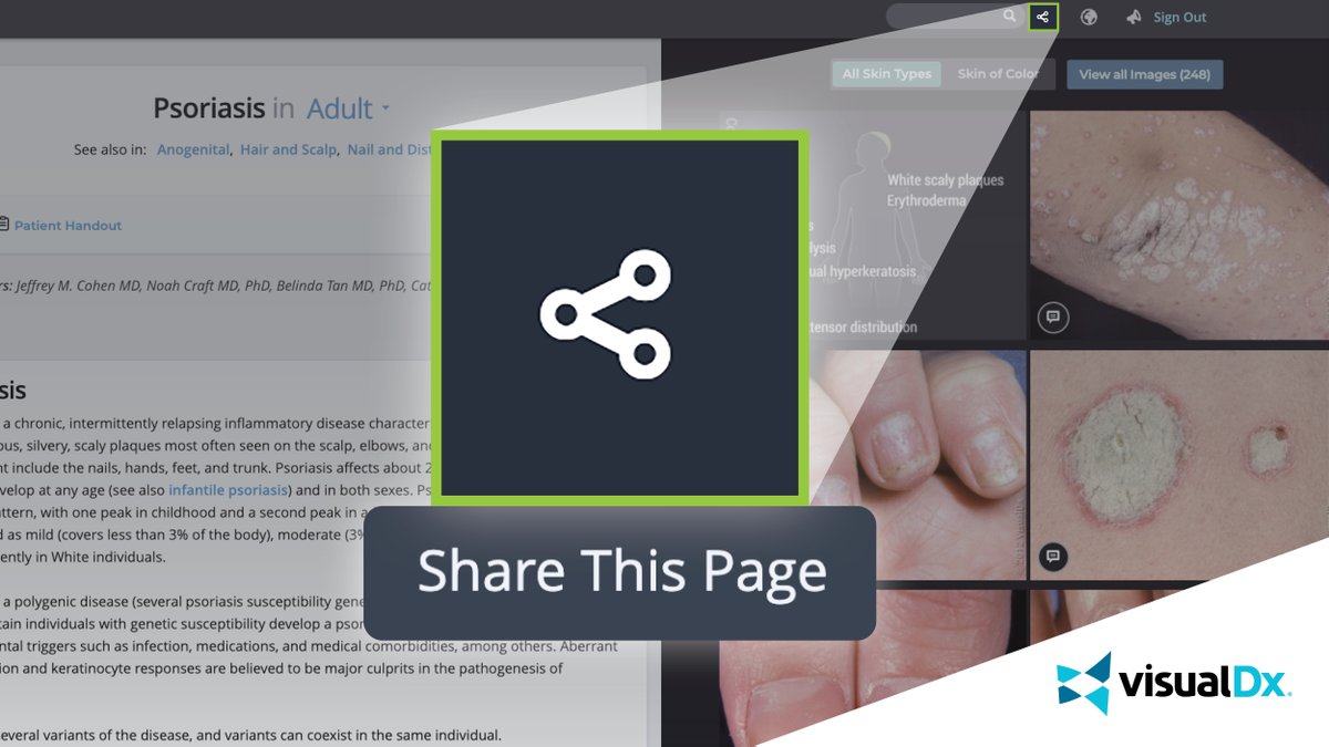 VisualDx's tweet image. 💡Did you know that you can share a link to any page in the product from the homepage to a differential or even a diagnosis?  Learn more: visualdx.com
#visualDx #sharethispage #sharingfeature