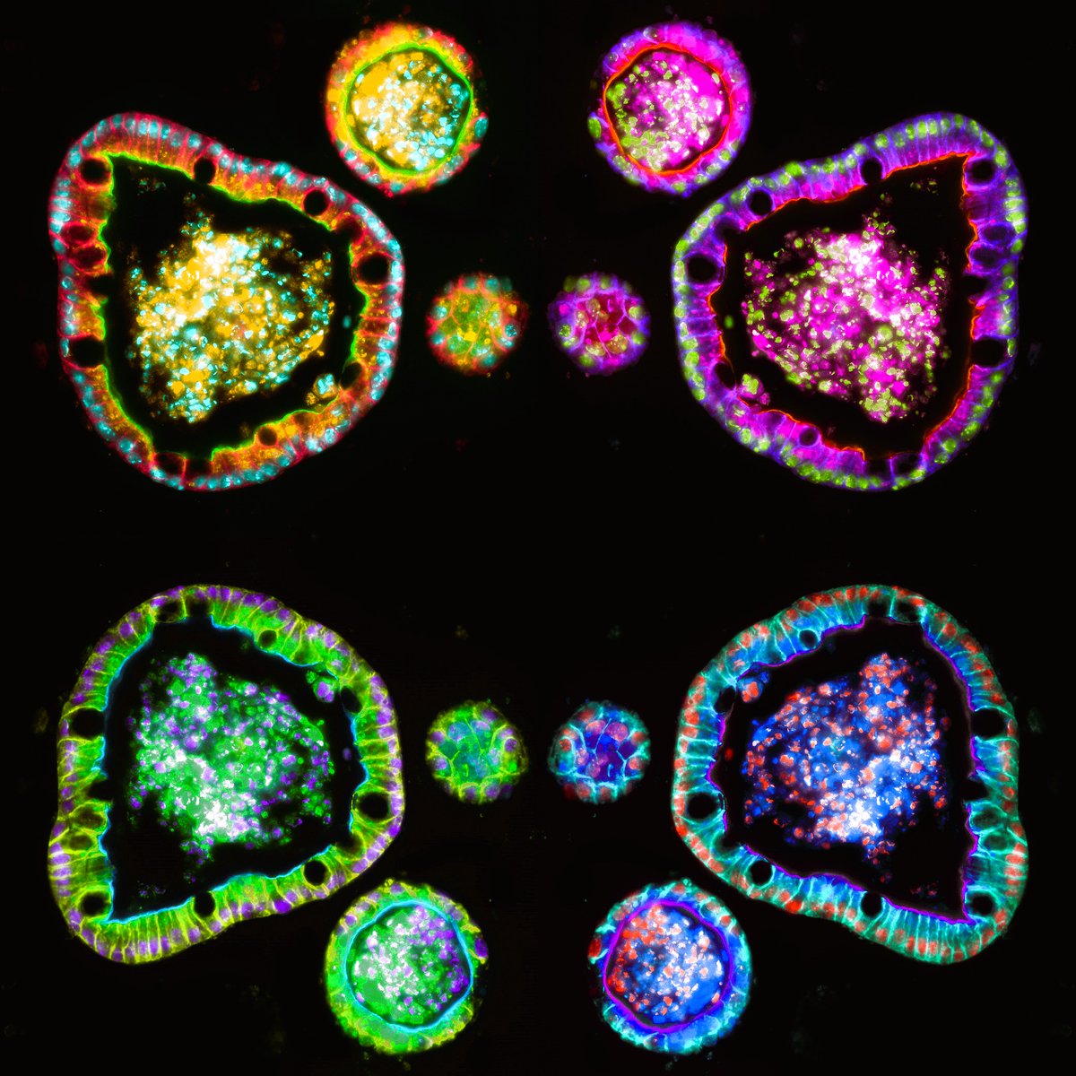 An organoid Rorschach test for #FluorescenceFriday 

#bioart #sciart #organoid #microscopy