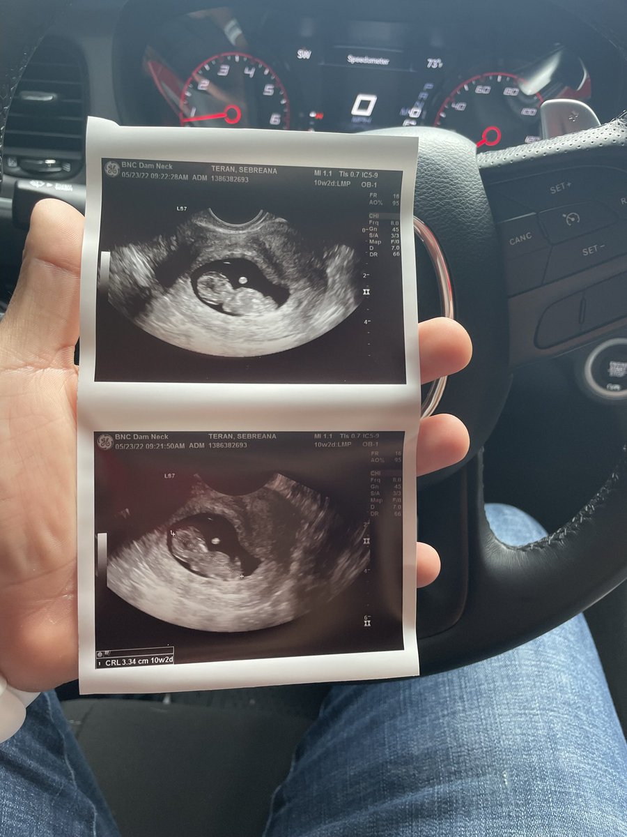 jvvcxxb's tweet photo. Life update ❤️👣 @SVBBYY https://t.co/1AL4Hz3ua9