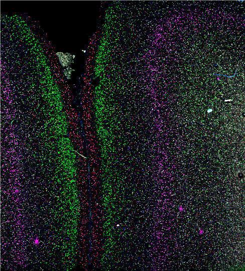 sanghokwon17's tweet photo. Cortical layers in the human🧠#FluorescenceFriday #RNAscope https://t.co/eTCPRf53QR