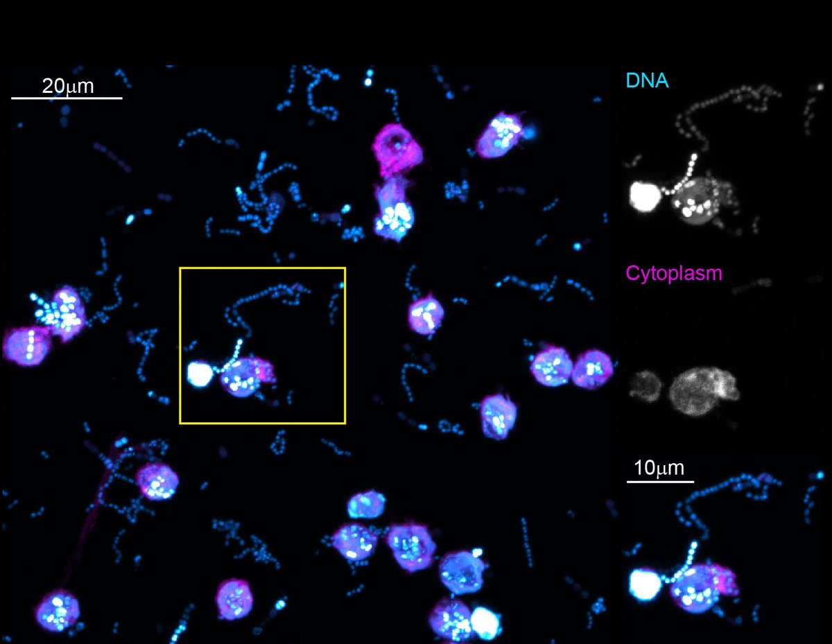 AUSSOCMIC's tweet photo. Signing off for the week, thanks for having me 🙂 Hope to catch up and hear about your research at the upcoming #ASM22 conference @claudiajades 😁. I'll be presenting my work on neutrophil-biofilm interactions, little preview below 🔬🦠🧫 [E.faecalis biofilm -/+ neutrophils] 👋🏻 https://t.co/7gOj6o9I9u