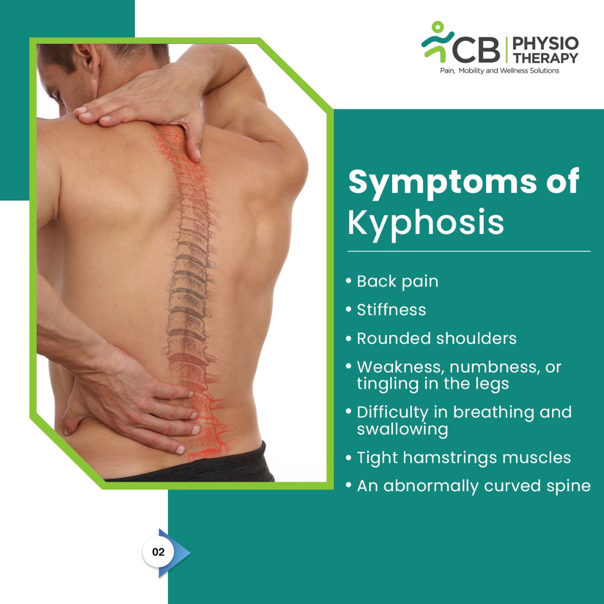 CBPhysioAH's tweet photo. ✅Individual bones(vertebrae) that make up a healthy spine usually look like cylinders stacked in a column. 

✅Kyphosis occurs when these bones/vertebrae in the upper back become more wedge-shaped.

KNOW MORE ABOUT KYPHOSIS BELOW

#kyphosis #hunchedback #roundback #vertebrae https://t.co/Cj5ko0Cp73