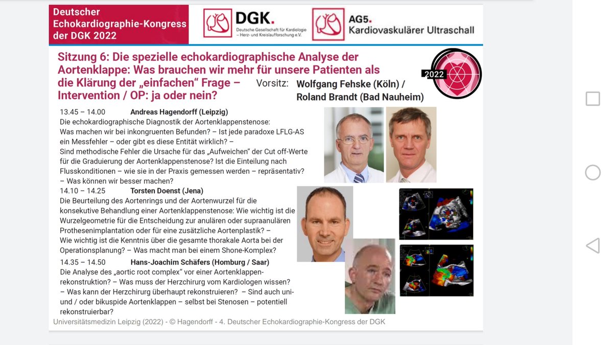 Live is better than online. Hotline Session Aortenklappenstenose am Samstag, den 25. Juni 2022 auf dem Deutschen Echokardiographie Kongress der DGK in Leipzig. Anmeldung echokardiographie-leipzig.de #echofirst #echoDGK22