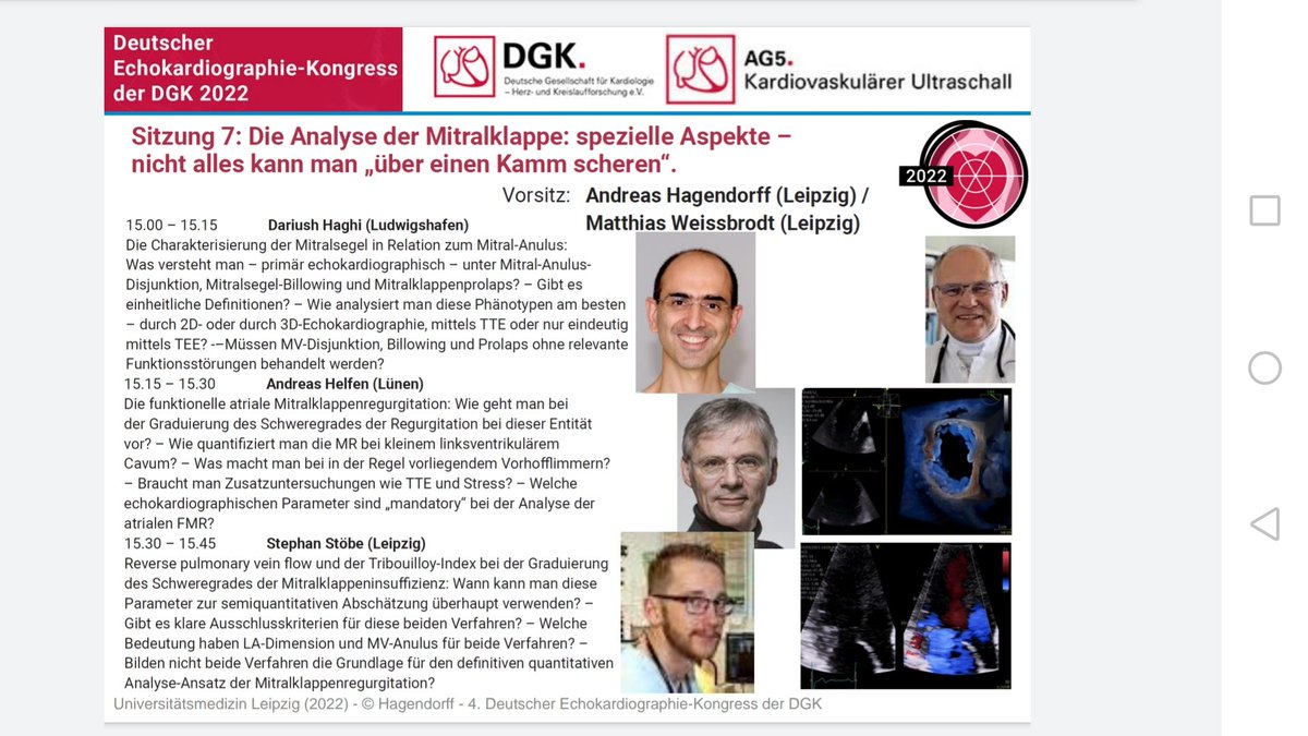 Live is better than online. Hotline Session Mitralklappeninsuffizienz am Samstag, den 25. Juni 2022 auf dem Deutschen Echokardiographie Kongress der DGK in Leipzig. Anmeldung echokardiographie-leipzig.de #echofirst #echoDGK22