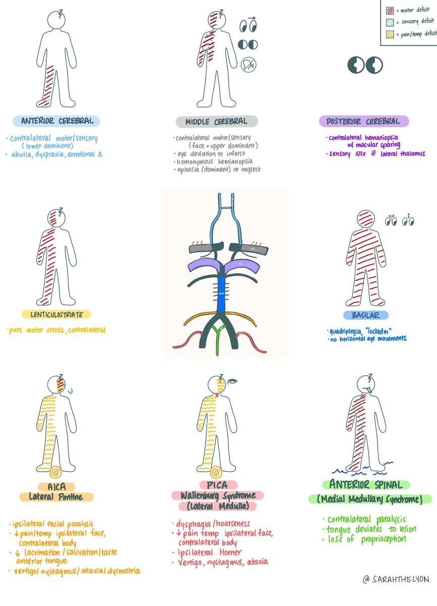 Oren Gottfried, MD (@ogdukeneurosurg) on Twitter photo An easy way to learn stroke presentations and localize the lesion by ā¦<a href="/sarahthelyon/">Sarah Lyon MD</a>ā© An easy way to learn stroke presentations and localize the lesion by ā¦<a href="/sarahthelyon/">Sarah Lyon MD</a>ā©
