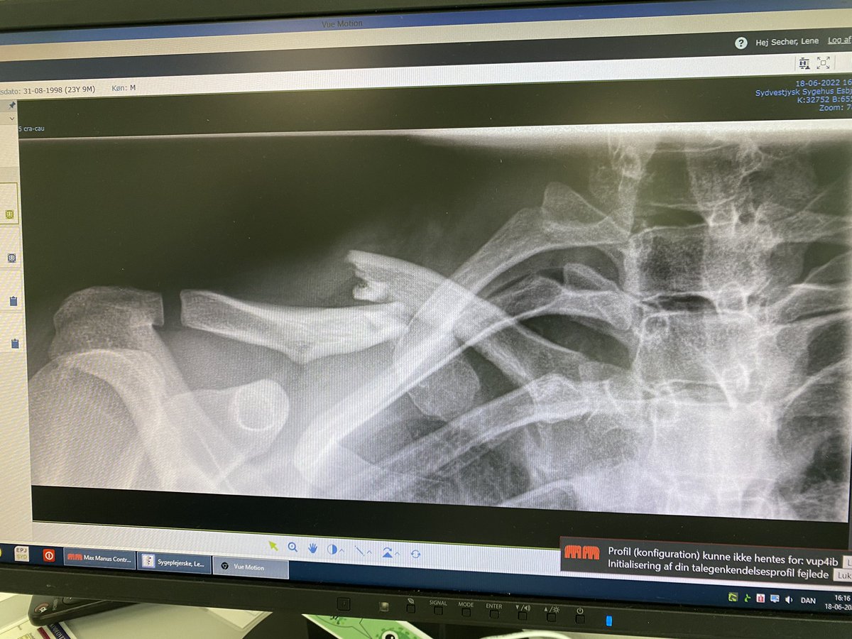 Malthe Jensen tweet media