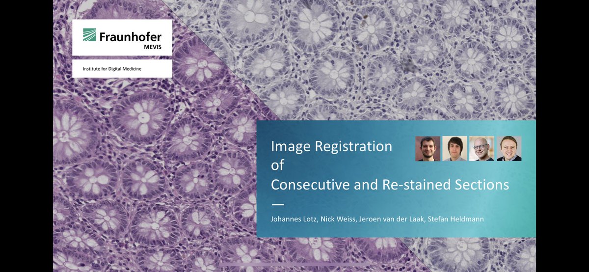 johannes_lotz's tweet image. Heading back home from @ESDIPatho #ECDP2022. It was great to talk about image registration in #computationalpathology and to discuss with everyone in person again. Thanks to the organizing team for making this such a smooth experience! 
@NormanZerbe @trkiehl