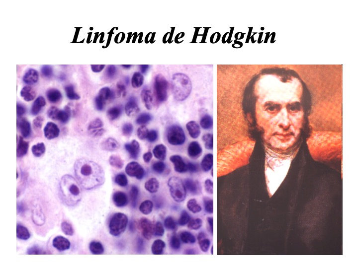 RamonGarciaSanz's tweet photo. ¿Cómo nació la quimioterapia para tratar el cáncer?

Resulta curioso saber que la curación de muchos cánceres comenzó tratando un linfoma de Hodgkin con un arma de guerra 

Abro hilo... https://t.co/UcpNFdcRMV
