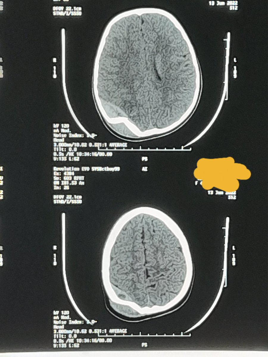 Olivier Tuyinama tweet media