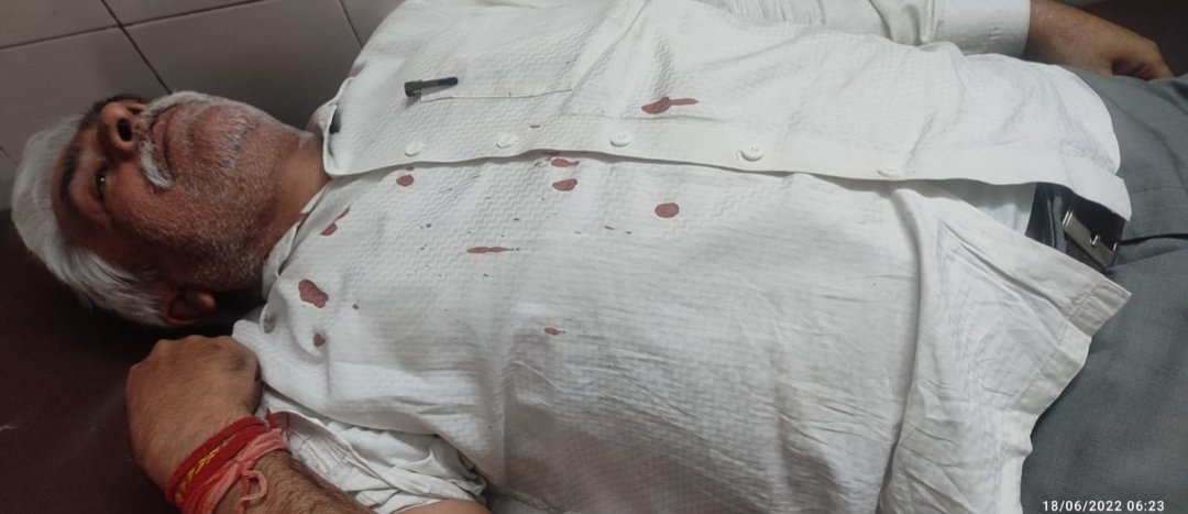 बिजनौर मे बिजली अभियन्ता पर हुये प्राणलेवा हमले के अभियुक्तो तत्काल गिरफ्तारी कर कड़ी कार्यवाही न होने से प्रदेश भर मे बिजली कार्मिको मे व्यापक असन्तोष व आक्रोश।
●प्रदेश भर मे बिजली-कार्मिको पर लगातार हो रहे हमले।
●अपराधियो का मनोबल भारी।