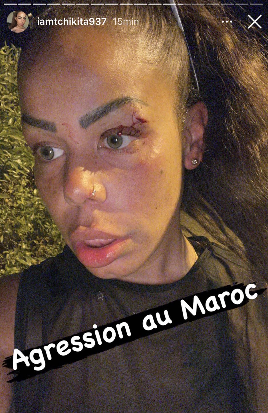 MM ۞ on X: 🔴🇲🇦🇫🇷— Linfluenceuse Française Tchikita a été agressée à  Marrakech après avoir tenu des propos insultants envers le Maroc et les  femmes Marocaines. t.coS8cH6KHD8R  X