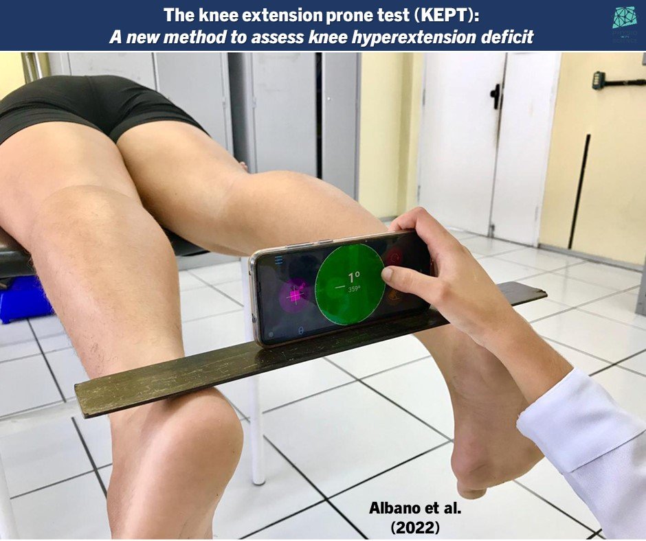 The knee extension prone test (KEPT): A new method to assess knee hyperextension deficit 

🦵 🦵 🦵

sciencedirect.com/science/articl…