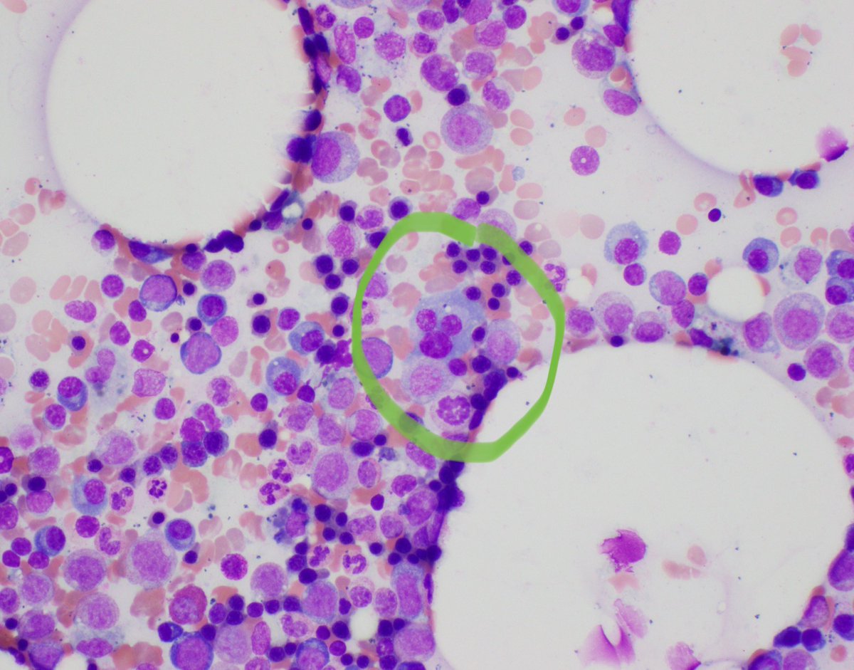 MoAli_Path's tweet photo. When you are an Orlando Pathologist!!! #hemepath #pathfun https://t.co/jM1Dm2tonH