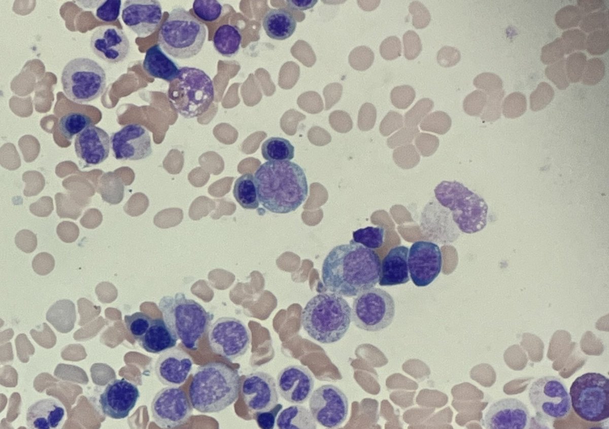 MoAli_Path's tweet photo. When you are an Orlando Pathologist!!! #hemepath #pathfun https://t.co/jM1Dm2tonH