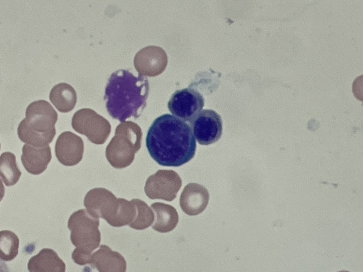 MoAli_Path's tweet photo. When you are an Orlando Pathologist!!! #hemepath #pathfun https://t.co/jM1Dm2tonH