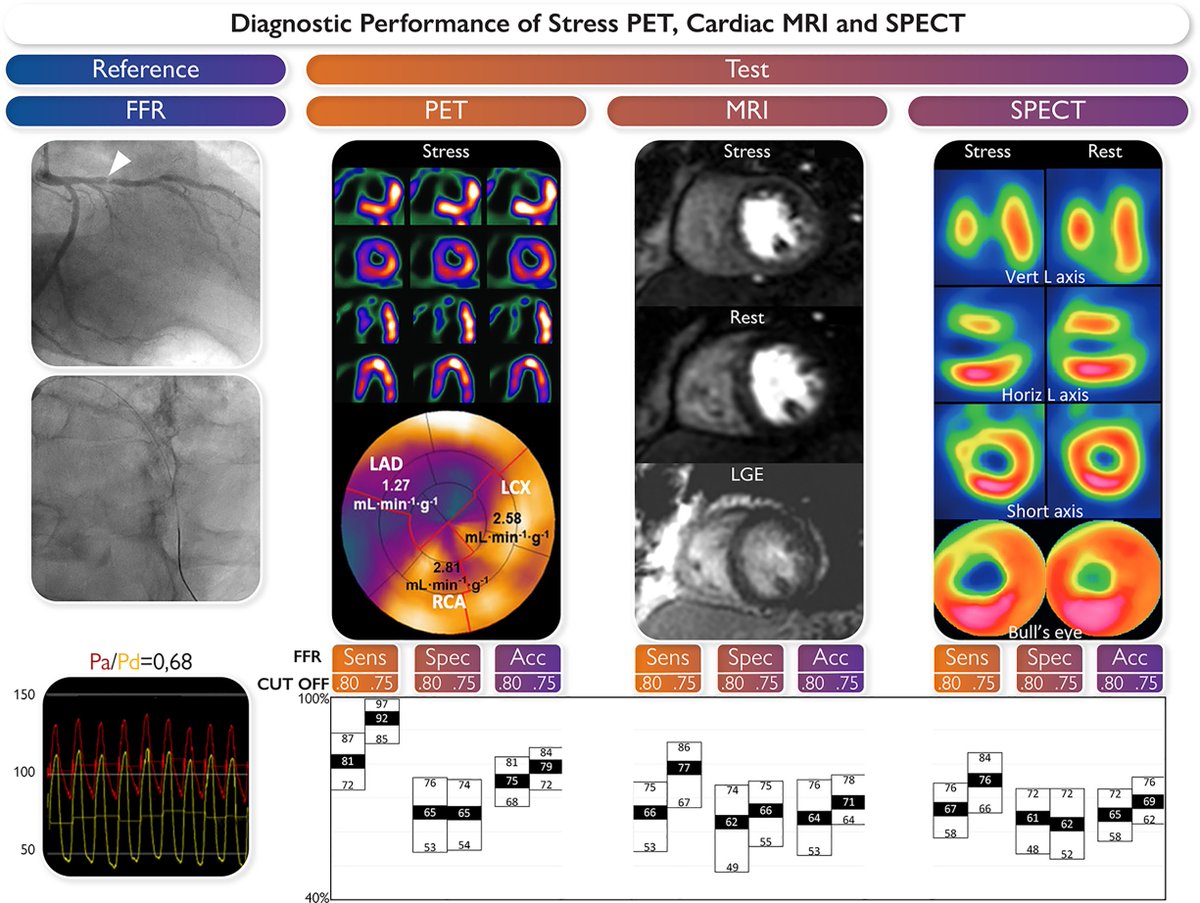 EHJ Editor-in-Chief (@ehj_ed) on Twitter photo Stress imaging versus fractional flow reserve: what comes first—the chicken or the egg?
academic.oup.com/eurheartj/adva…
#PET #stress #imaging #FFR #cardiotwitter <a href="/escardio/">European Society of Cardiology</a> <a href="/ESC_Journals/">European Society of Cardiology Journals</a> Stress imaging versus fractional flow reserve: what comes first—the chicken or the egg?
academic.oup.com/eurheartj/adva…
#PET #stress #imaging #FFR #cardiotwitter <a href="/escardio/">European Society of Cardiology</a> <a href="/ESC_Journals/">European Society of Cardiology Journals</a>