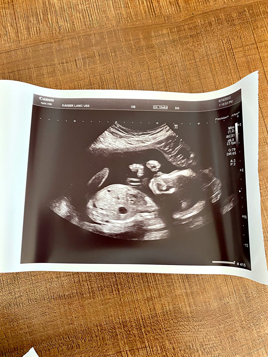 taesuh's tweet photo. The 20 week ultrasound got me weak 🥹🥹🥹 https://t.co/yQxoewjkVe