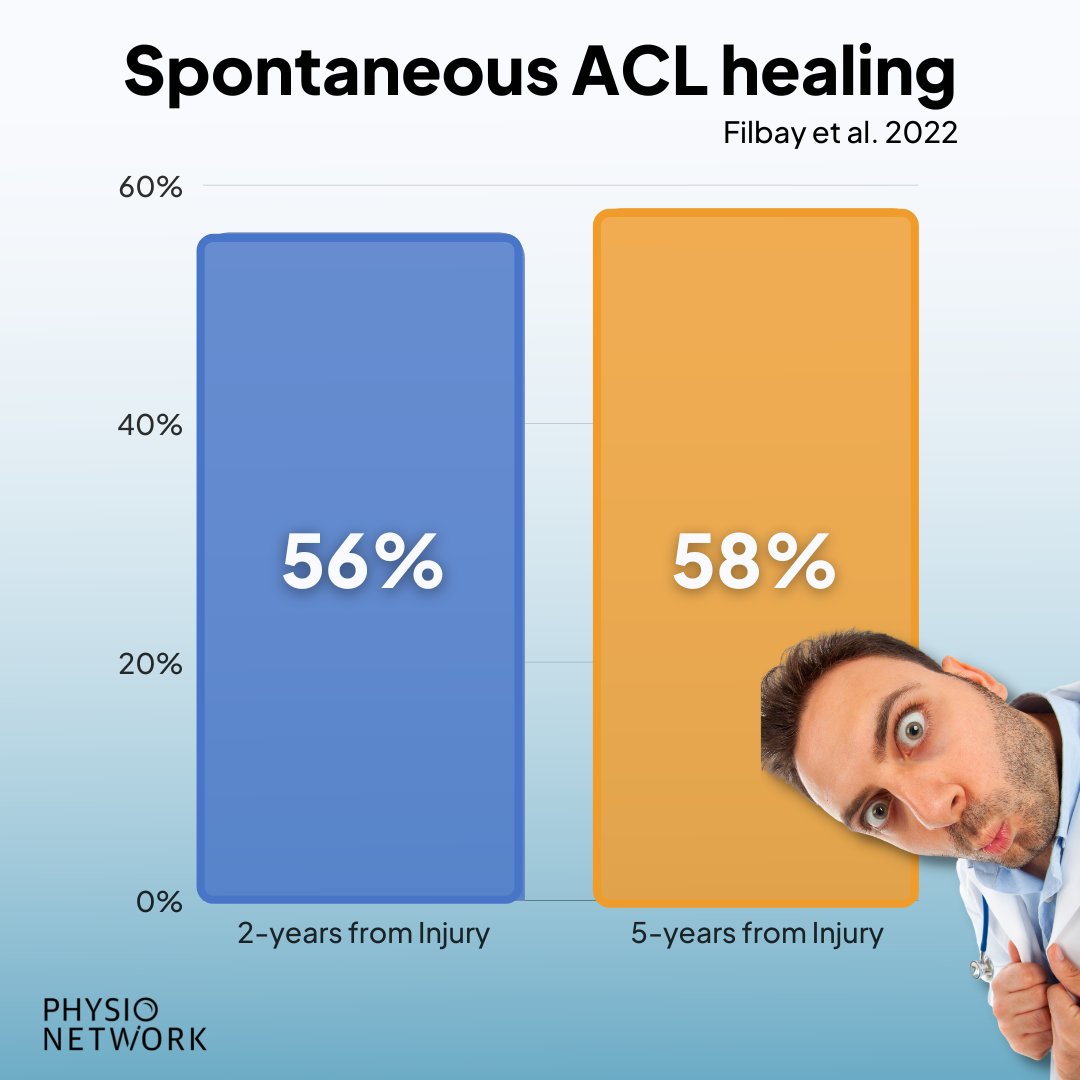PhysioNetwork's tweet photo. 🤨 Can ruptured ACLs heal without surgery? 

📚 Yes, according to this new paper by Filbay et al (2022).

🔍 Following management with rehabilitation-alone at 5-years (n=26), 56% had a healed-ACL at 2-years and 58% at 5-years.

👀 Does this surprise you? https://t.co/9sYtfk6Ywq