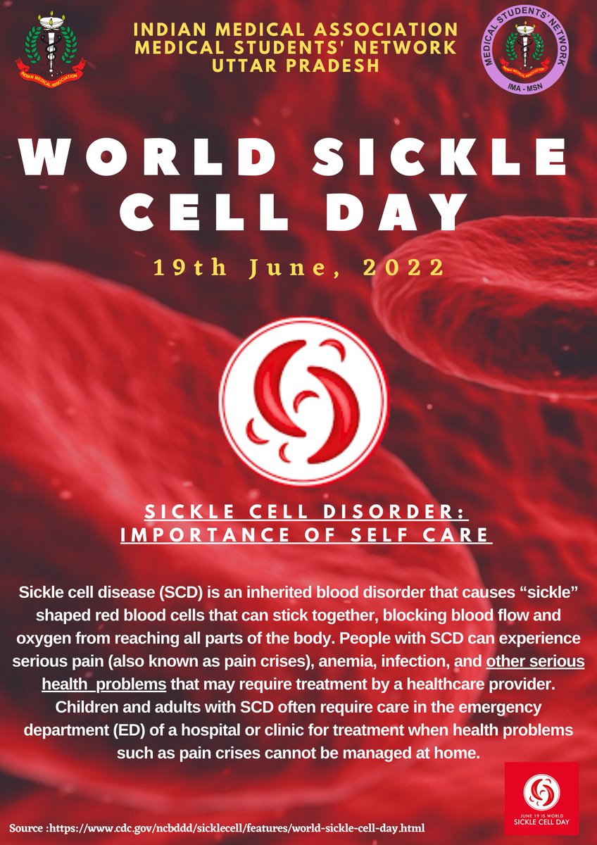 World Sickle Cell Day | 19th June, 2022

<a href="/imajdnnational/">IMA JDN National</a> <a href="/HqsMsn/">IMA-MSN (HQs) Official</a> <a href="/IndianMedAssn/">Indian Medical Association (HQs.)</a> <a href="/IMA_MSNIndia/">IMA MSN HQs</a> <a href="/Dr_AkashVerma/">Dr.AKASH VERMA</a> <a href="/AbhiJha444/">Dr.Abhishek Jha</a>