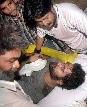 Prakash97623147's tweet photo. @GaneshTweetzz_ @DurgaNarse @tarak9999 Annna epudu pothav kastaa chepthavaaa??? #RIPpig https://t.co/TbrgyUcMKw