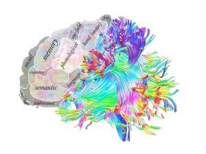 BrainStrucFunc's tweet photo. Submit your updated brain parcellation to Brain Structure and Function (no submission or article processing charges) to our special issue edited by Sarah Genon &amp; Michel Thiebaut de Schotten https://t.co/WQq1RZOvMd @OHBM #OHBM2022 #brainPFT come talk to us directly if interested. https://t.co/cVl99PjJGI