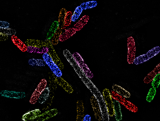 GENbio's tweet photo. Aging Peptidoglycans Control Outer Membranes in Bacteria

A simple yet elegant mechanism ensures Gram-negative bacteria maintain a tight control over both cell envelope layers. Learn more: https://t.co/aJKenavrQg https://t.co/EctLFHPgEy