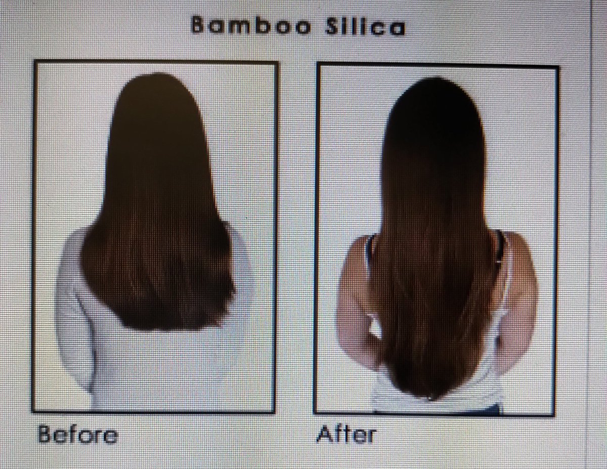 Kitil Farm tweet media