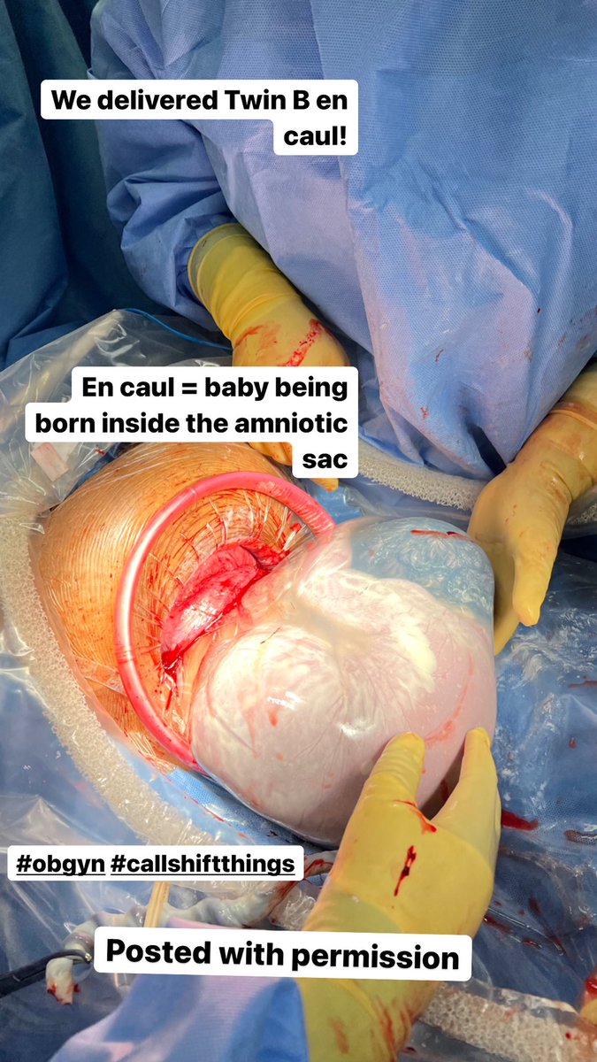 erynkw's tweet photo. #obgyn #encaul #twins #residency https://t.co/M7bfUwU4GZ