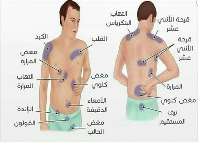 oruixi's tweet photo. خريطة توضح مناطق أنواع الألم .. https://t.co/huMNGmLfse