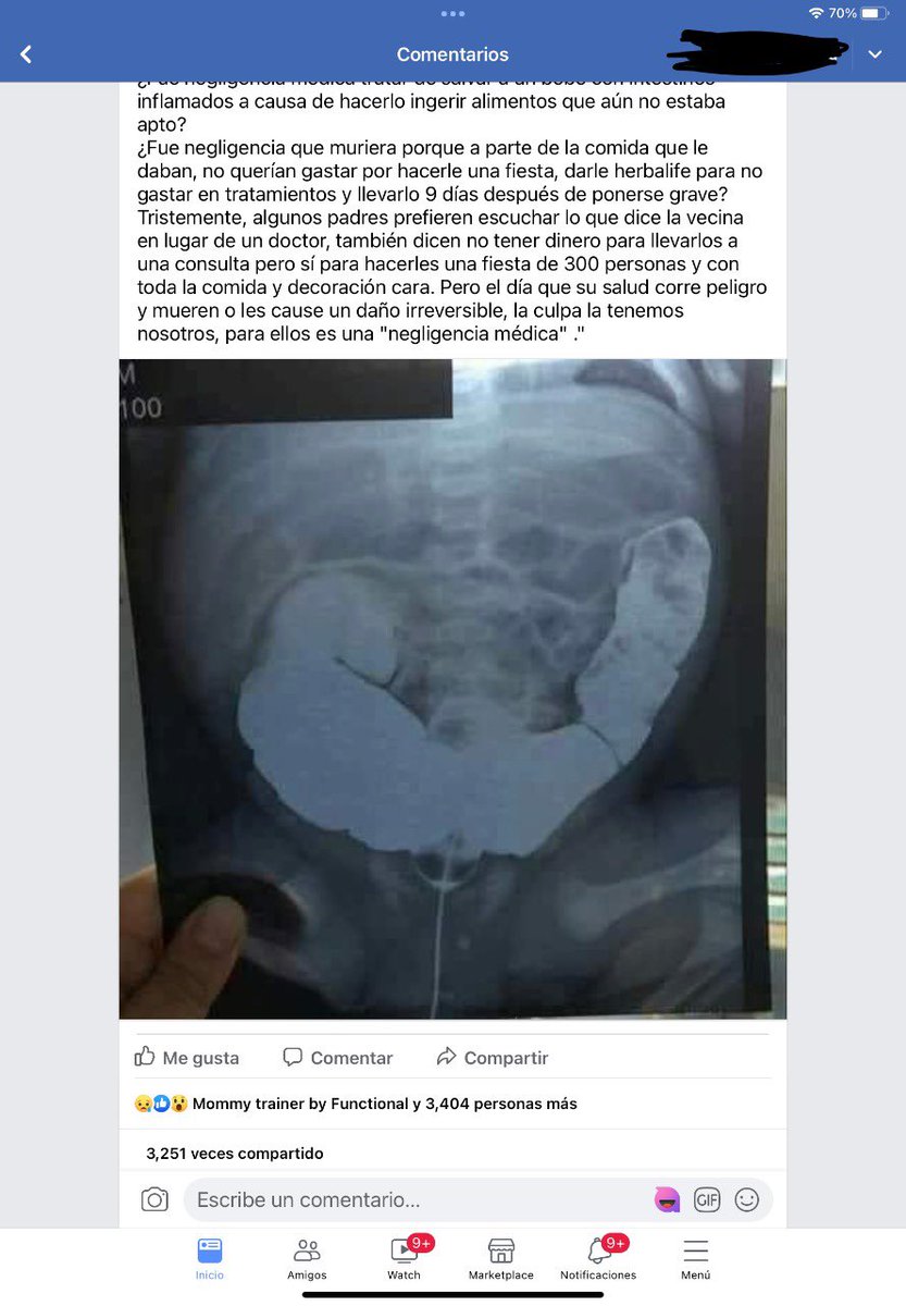 MrDoctorOficial's tweet photo. Miren lo que me encontré en FACEBOOK!!! 😡😡😡

LE DIO PASTEL A UNA BEBE DE 4 MESES 
🤬🤬🤬🤬 https://t.co/BmxNoMfyKy